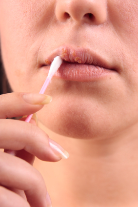 What Deficiency Causes Dry Cracked Lips