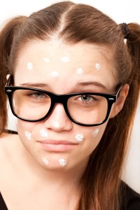 Acne Scarring Treatment