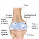 Knee Pain