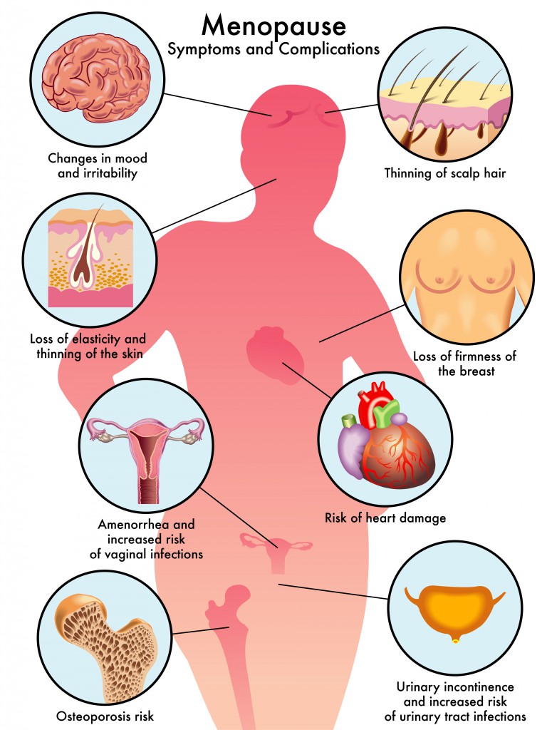 Menopause Symptoms.